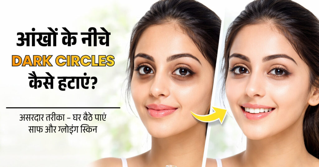 how to remove dark circles under eyes permanently at home