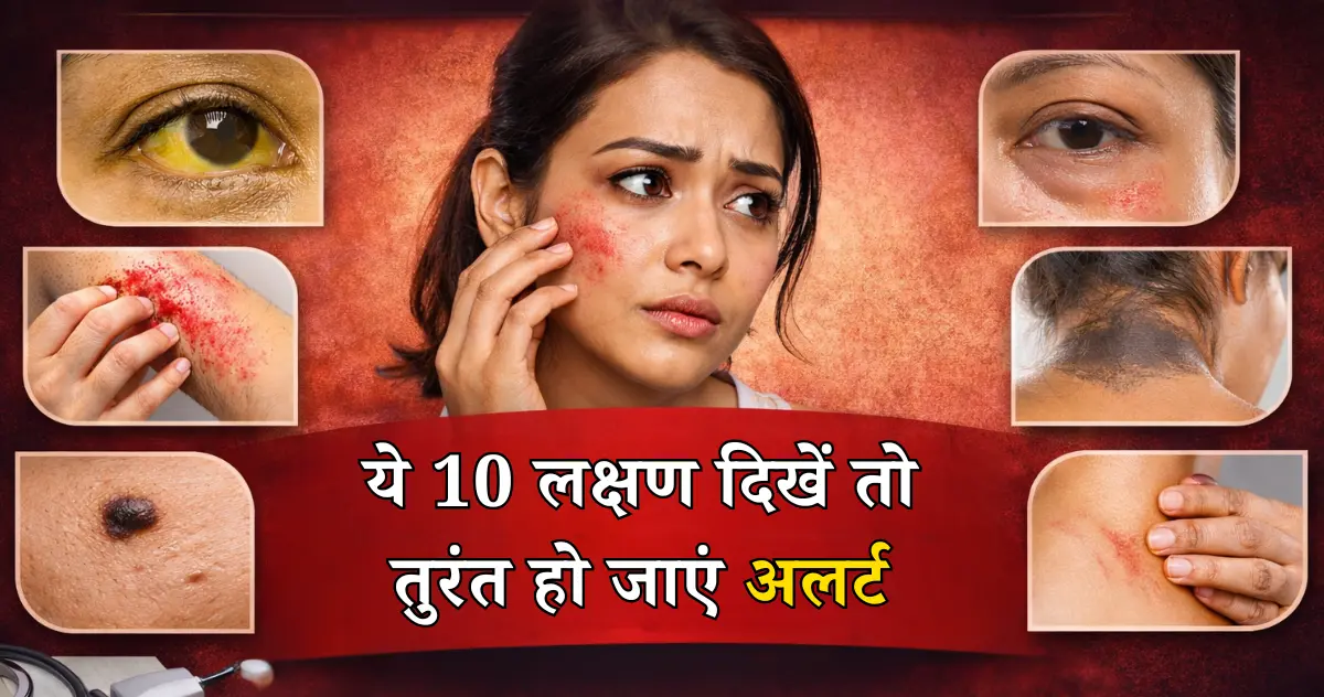 स्किन दे रही है शरीर की अंदरूनी बीमारियों का संकेत! ये 10 लक्षण दिखें तो तुरंत हो जाएं अलर्ट